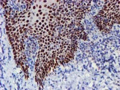 Immunohistochemistry: TAZ/WWTR1 Antibody (OTI1H9) - Azide and BSA Free [NBP2-74449]