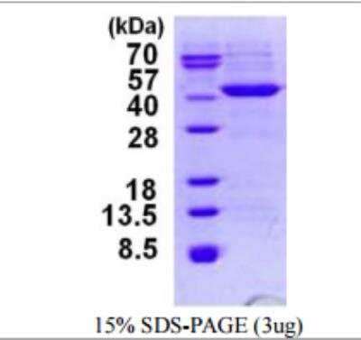 SDS-PAGE: Recombinant Mycobacterium tuberculosis Ab85A His Protein [NBP1-99035]