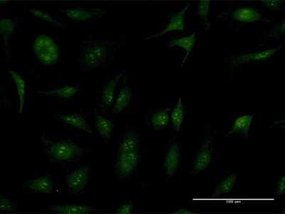 Immunocytochemistry/ Immunofluorescence: TBC1D1 Antibody [H00023216-B02P]