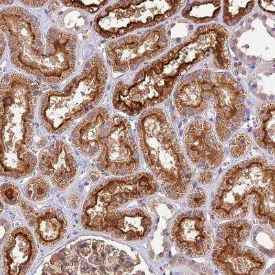 Immunohistochemistry-Paraffin: TBC1D1 Antibody [NBP1-82928]