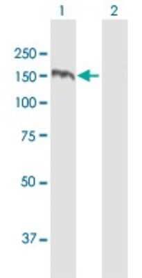 Western Blot: TBC1D1 Antibody [H00023216-B02P]