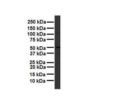 Western Blot: TBC1D1 Antibody [NBP1-54654]