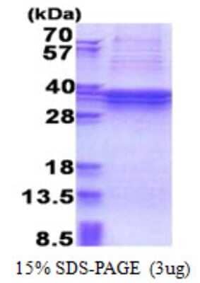 SDS-PAGE: Recombinant Human TBC1D1 His Protein [NBP2-22851]