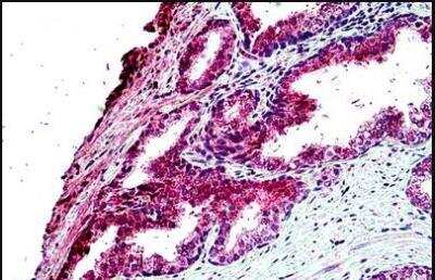 Immunohistochemistry-Paraffin: TBC1D10A Antibody [NBP2-61998]