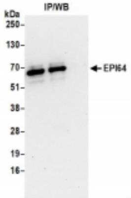 Immunoprecipitation: TBC1D10A Antibody [NBP2-36551]