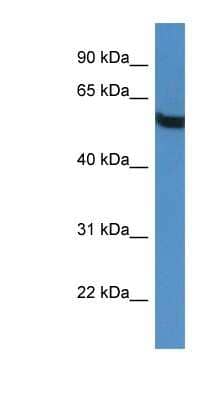 Western Blot: TBC1D10A Antibody [NBP1-79843]