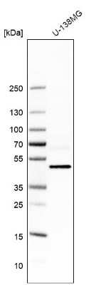 Western Blot: TBC1D10A Antibody [NBP1-89294]