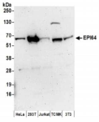 Western Blot: TBC1D10A Antibody [NBP2-36551]