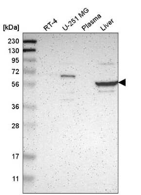 Western Blot: TBC1D10A Antibody [NBP2-58911]