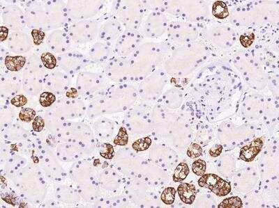 Immunohistochemistry-Paraffin: TBC1D10B Antibody [NBP3-05943]