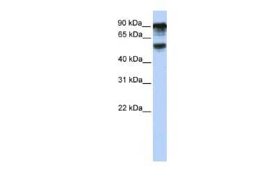 Western Blot: TBC1D10B Antibody [NBP2-83621]