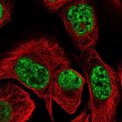 Immunocytochemistry/ Immunofluorescence: TBC1D12 Antibody [NBP1-93628]