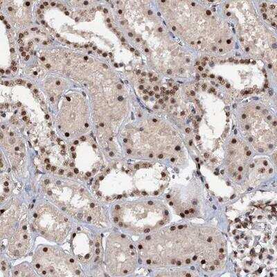 Immunohistochemistry-Paraffin: TBC1D12 Antibody [NBP1-93628]