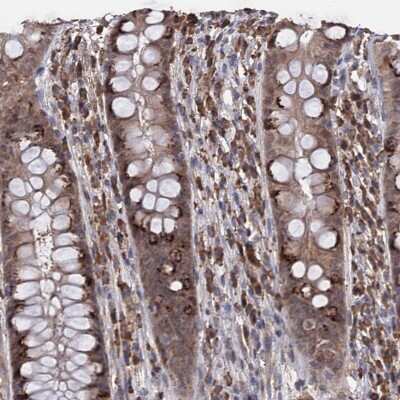 Immunohistochemistry-Paraffin: TBC1D12 Antibody [NBP1-93629]