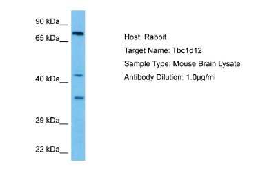 Western Blot: TBC1D12 Antibody [NBP2-85876]