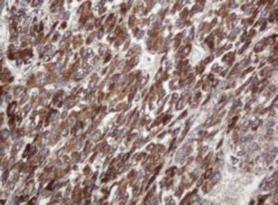 Immunohistochemistry: TBC1D13 Antibody (OTI2C5) [NBP2-45985]