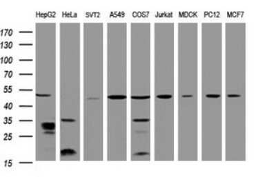 Western Blot: TBC1D13 Antibody (OTI2C5) [NBP2-45985]