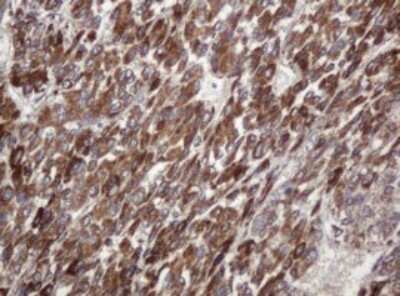 Immunohistochemistry: TBC1D13 Antibody (OTI2C5) - Azide and BSA Free [NBP2-74450]