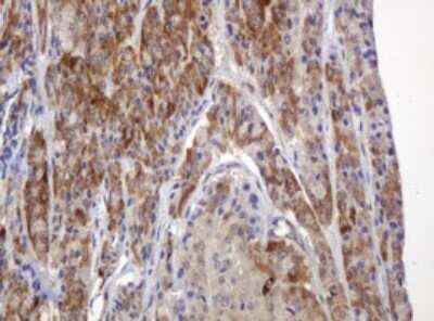 Immunohistochemistry: TBC1D13 Antibody (OTI2C5) - Azide and BSA Free [NBP2-74450]