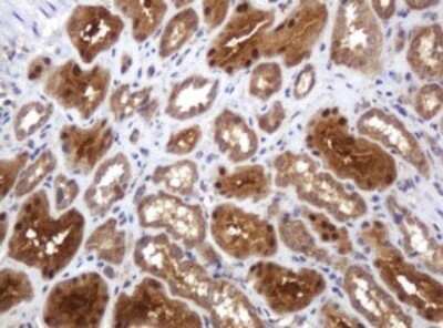Immunohistochemistry: TBC1D13 Antibody (OTI2C5) - Azide and BSA Free [NBP2-74450]