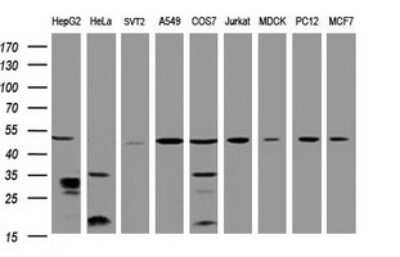 Western Blot: TBC1D13 Antibody (OTI2C5)Azide and BSA Free [NBP2-74450]