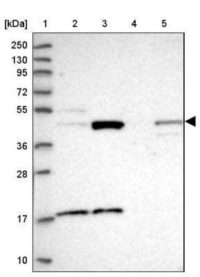 Western Blot: TBC1D13 Antibody [NBP1-92477]