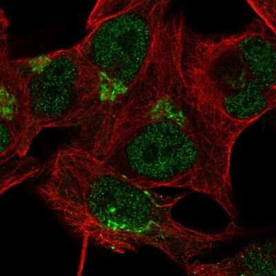 Immunocytochemistry/ Immunofluorescence: TBC1D14 Antibody [NBP2-57245]