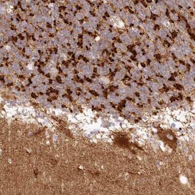 Immunohistochemistry-Paraffin: TBC1D14 Antibody [NBP1-82913]