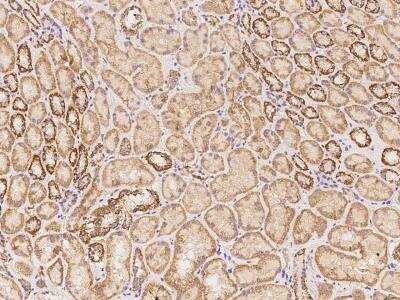 Immunohistochemistry-Paraffin: TBC1D14 Antibody [NBP3-06257]