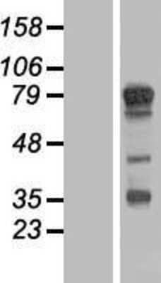 Western Blot: TBC1D14 Overexpression Lysate [NBL1-16722]