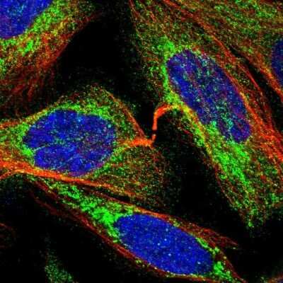 Immunocytochemistry/ Immunofluorescence: TBC1D15 Antibody [NBP1-90503]