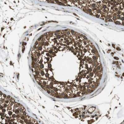 Immunohistochemistry-Paraffin: TBC1D15 Antibody [NBP1-90504]