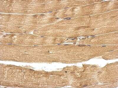 Immunohistochemistry-Paraffin: TBC1D15 Antibody [NBP2-20576]