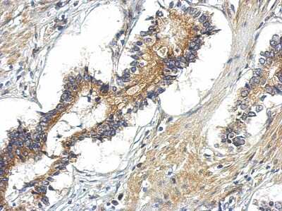Immunohistochemistry-Paraffin: TBC1D15 Antibody [NBP2-20576]