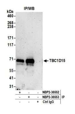 Immunoprecipitation: TBC1D15 Antibody [NBP2-36552]