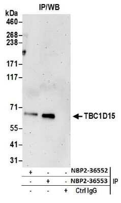 Immunoprecipitation: TBC1D15 Antibody [NBP2-36553]