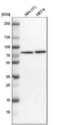 Western Blot: TBC1D15 Antibody [NBP1-90503]