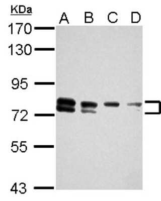 Western Blot: TBC1D15 Antibody [NBP2-20576]