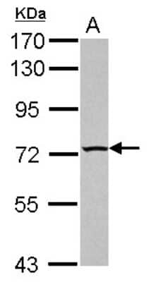 Western Blot: TBC1D15 Antibody [NBP2-20577]