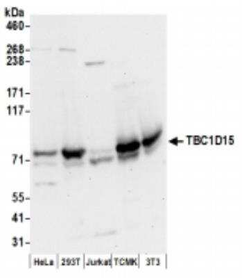 Western Blot: TBC1D15 Antibody [NBP2-36552]