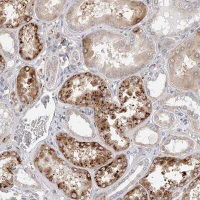 Immunohistochemistry-Paraffin: TBC1D16 Antibody [NBP1-83635]