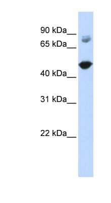 Western Blot: TBC1D16 Antibody [NBP1-55489]