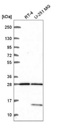 Western Blot: TBC1D16 Antibody [NBP2-57468]