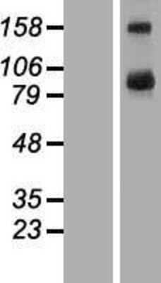 Western Blot: TBC1D16 Overexpression Lysate [NBL1-16724]