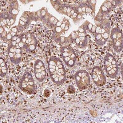 Immunohistochemistry-Paraffin: TBC1D17 Antibody [NBP2-49546]