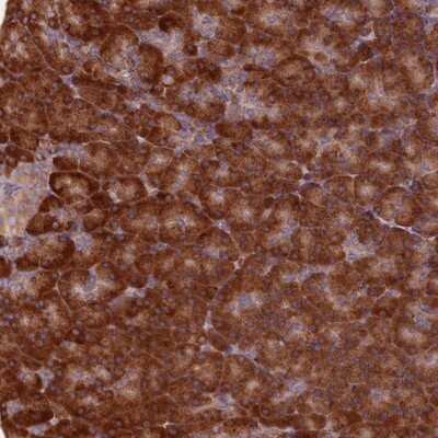 Immunohistochemistry-Paraffin: TBC1D19 Antibody [NBP1-84600]