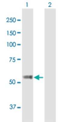 Western Blot: TBC1D19 Antibody [H00055296-B01P]