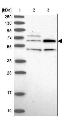 Western Blot: TBC1D19 Antibody [NBP1-84600]