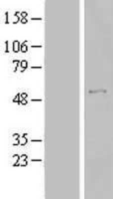 Western Blot: TBC1D19 Overexpression Lysate [NBL1-16725]