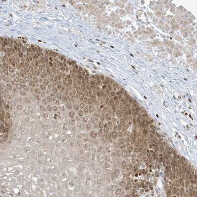 Immunohistochemistry-Paraffin: TBC1D2 Antibody [NBP1-87335]